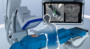 Philips introduces ClarifEye Augmented Reality Surgical Navigation
